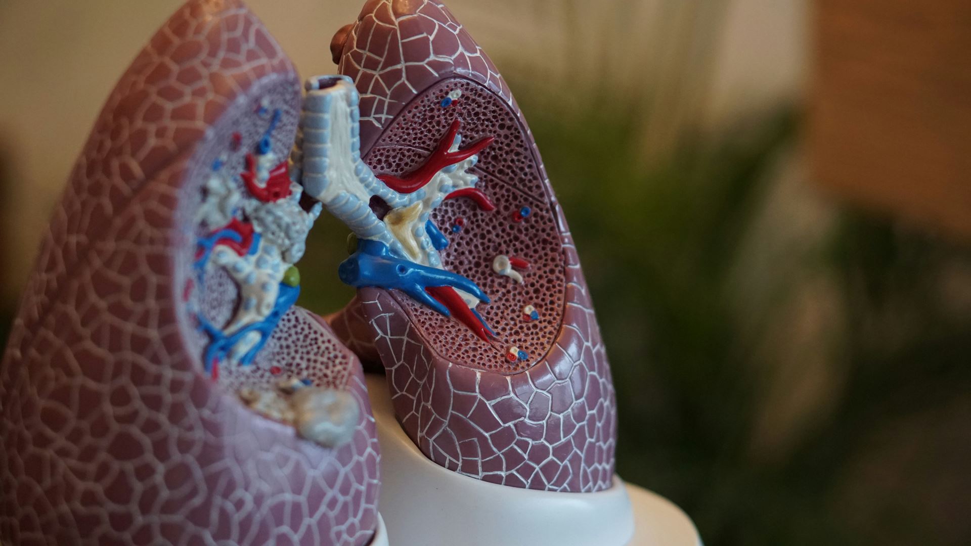 Asthma